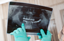 Ochrona-radiologiczna-pacjenta-dla-Stomatologow